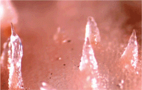 i0007-9367-83-5-188-f1602.gif